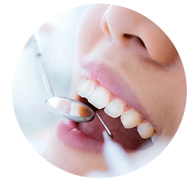歯茎の検査の流れ