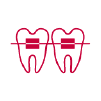 小児矯正