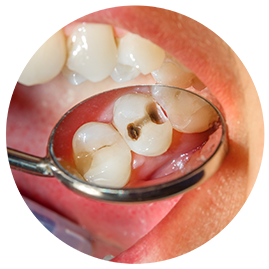 歯茎の検査の流れ