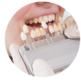 1.カウンセリング・治療前の歯のチェック