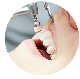 3.歯のクリーニングと自宅での使用法説明